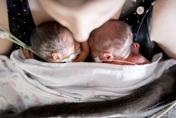 Pierwszy taki przypadek na świecie. Chorobę wykryto u dwóch braci z trojaczków