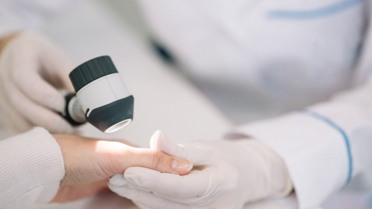 Kapilaroskopia to metoda diagnozowania problemów z mikrokrążeniem.