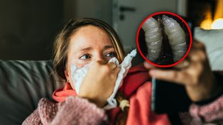 Kobieta "wykichała" larwy much. Rzadki przypadek opisany przez CDC