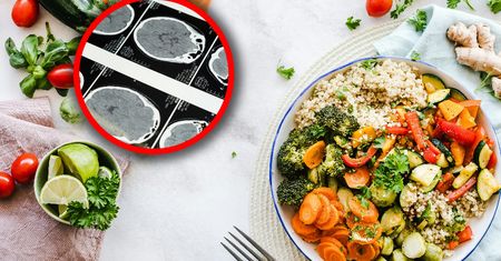 Tą dietą możesz obniżyć ryzyko choroby Alzheimera. Nowe badania