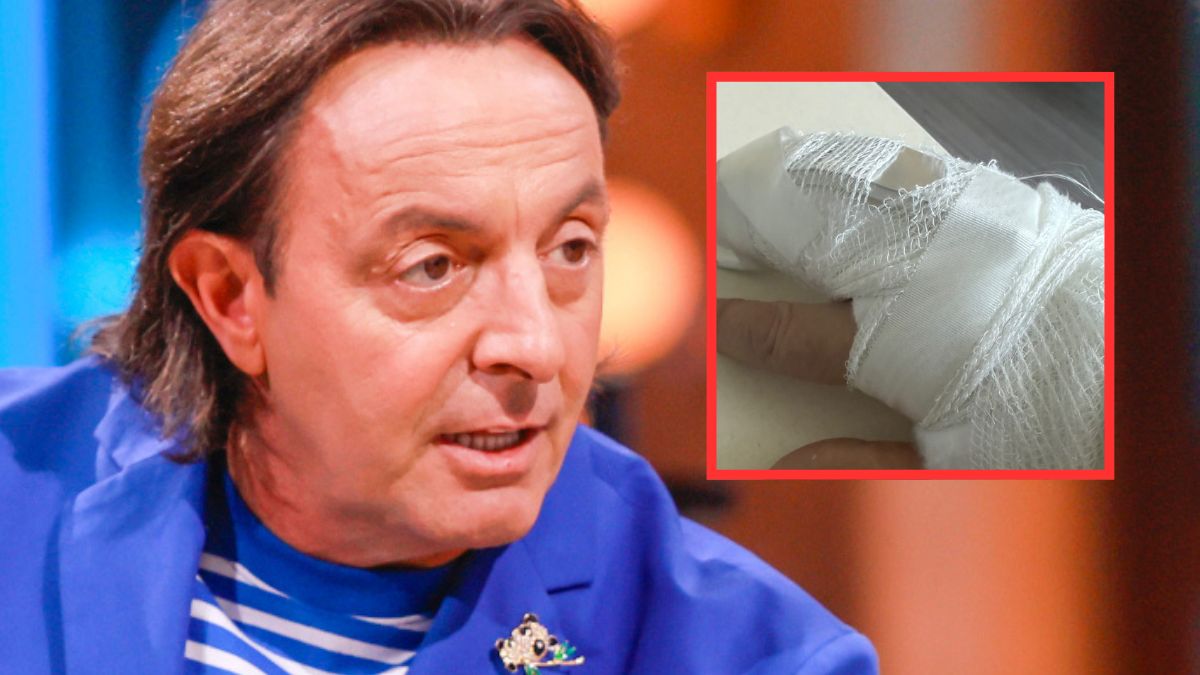 Michel Moran złamał palca.