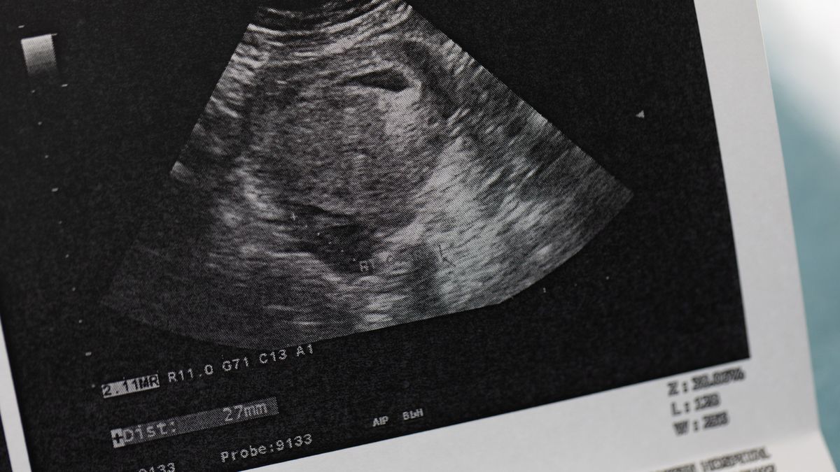 13-latka zaszła w ciążę z 10-latkiem? Zdecyduje badanie DNA