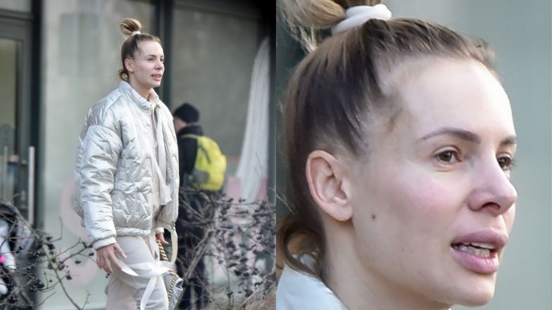 Izabela Janachowska mknie do kliniki stomatologii estetycznej  