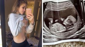Młoda mama pokazuje swój niesamowicie płaski brzuch w 6 miesiącu ciąży