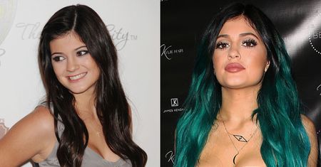 Lekarka o 18-letniej Kylie Jenner: "Jestem pewna, że ZROBIŁA SOBIE BIODRA I TYŁEK"