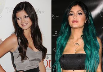 Lekarka o 18-letniej Kylie Jenner: "Jestem pewna, że ZROBIŁA SOBIE BIODRA I TYŁEK"