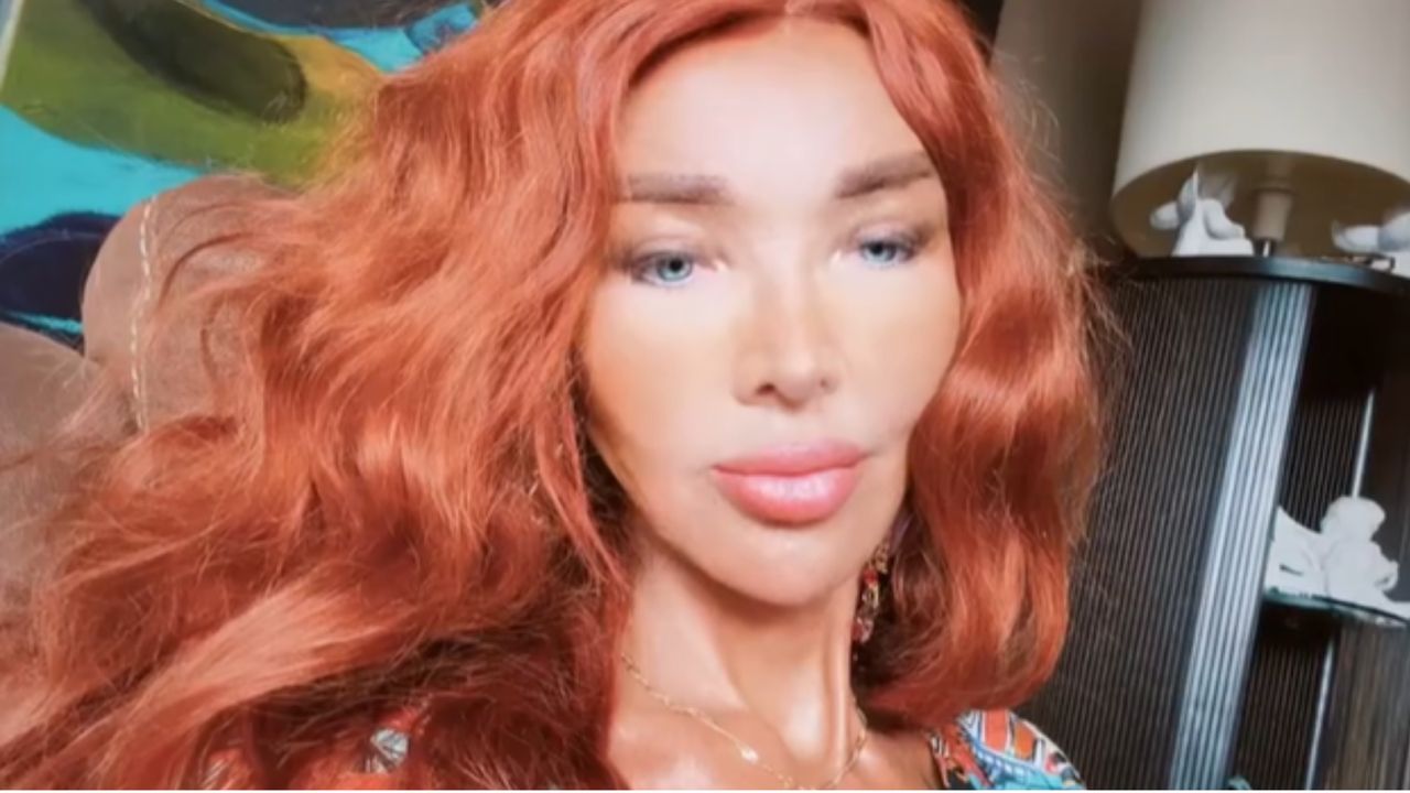 Ewa Minge o liftingu, implantach i modzie na operacje. Ostrzega przed zabiegami w Turcji