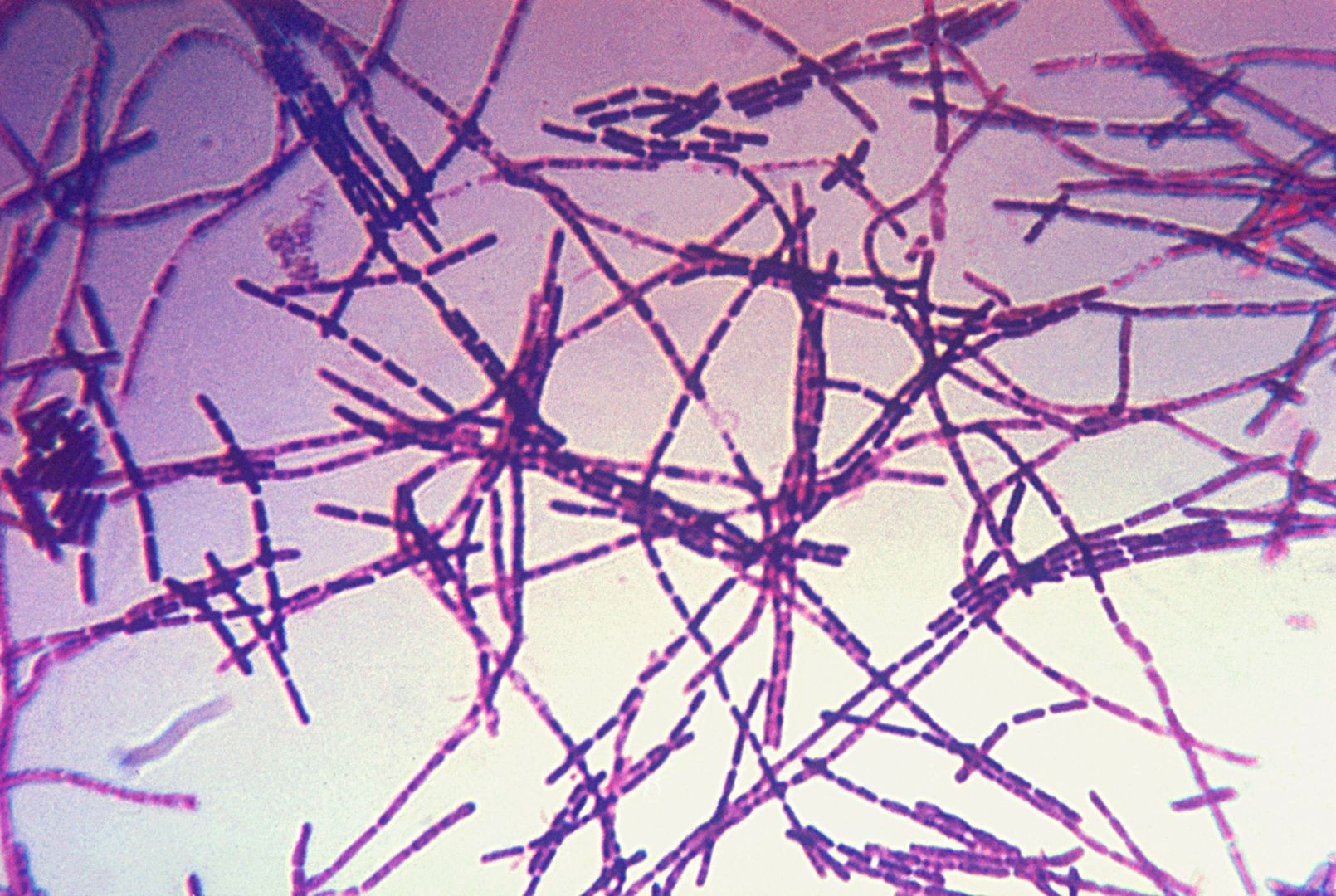 Laseczka wąglika (Bacillus anthracis)