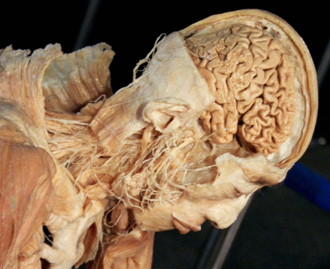 Czy ludzki mózg się skurczył z powodu rolnictwa? (Fot. na lic. CC; Flickr.com/by jemsweb)