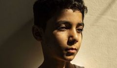 Oto Zdjęcie Roku w konkursie World Press Photo 2025. Przedstawia chłopca, który stracił rękę w Strefie Gazy