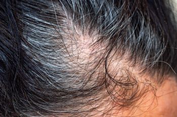 Nałóż zamiast farby na siwe włosy. Naturalny "odsiwiacz"