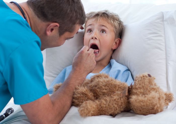 Zapalenie migdałków