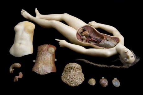 Trochę inne spojrzenie na historię medycyny w Londyńskim Muzeum Nauki 5