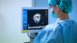 Ultrasonografia wewnątrznaczyniowa - charakterystyka, wskazania i przebieg badania