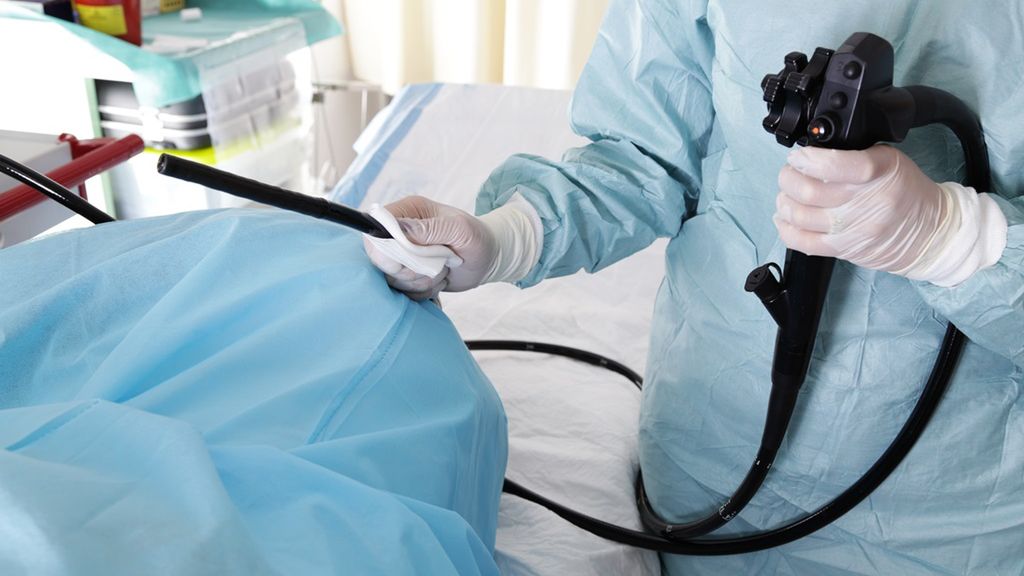 Kolonoskopia to wprowadzenia cienkiego narzędzia zwanego kolonoskopem do jelita grubego w celach diagnostycznych i leczniczych