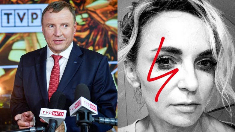Anna Wyszkoni komentuje atak TVP