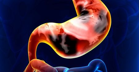 Nowotwory neuroendokrynne rozwijają się powoli i często niezauważalnie. Co należy o nich wiedzieć?