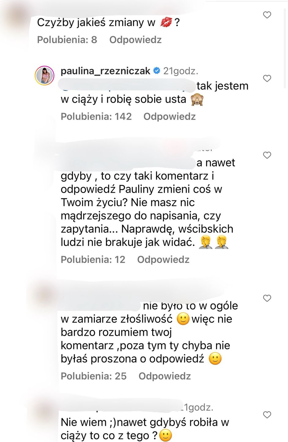 Internautka sugeruje, że Paulina Rzeźniczak powiększyła usta