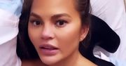 Chrissy Teigen w szpitalu. Fani obawiali się o jej ciążę