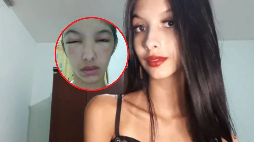 To składnik farby do włosów spowodował ten koszmar