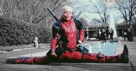 Zdjęcia ofiary poparzeń w cosplayu Deadpoola zwróciły uwagę Ryana Reynoldsa