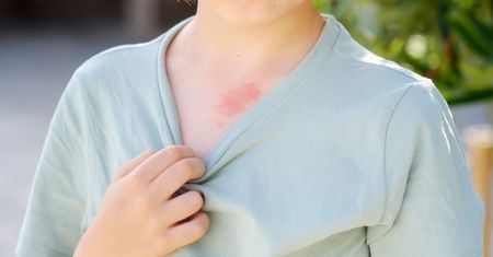 Malformacje naczyniowe – przyczyny, objawy i leczenie