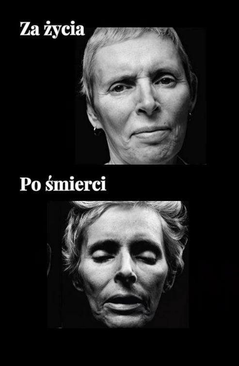 Tak zmieniały się twarze pacjentów