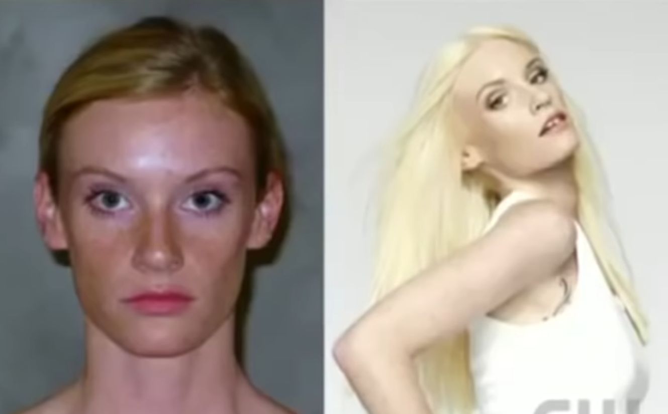 Modelka zgodziła się poszerzyć diastemę 