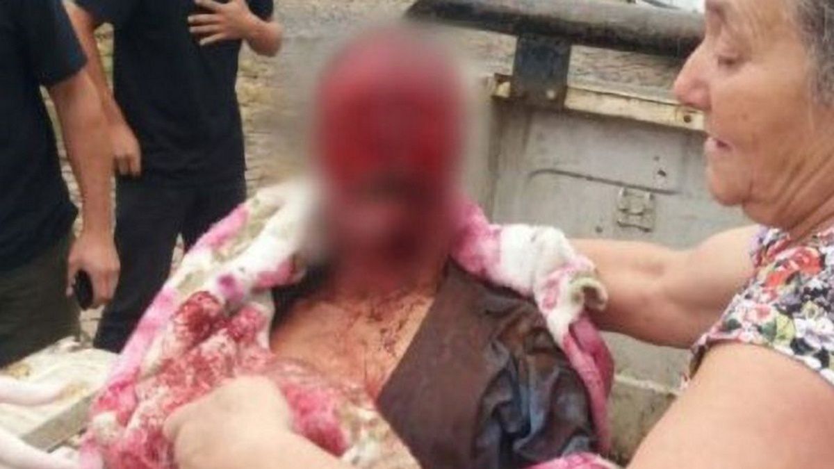 Mężczyzna zaraz po tragicznym zdarzeniu