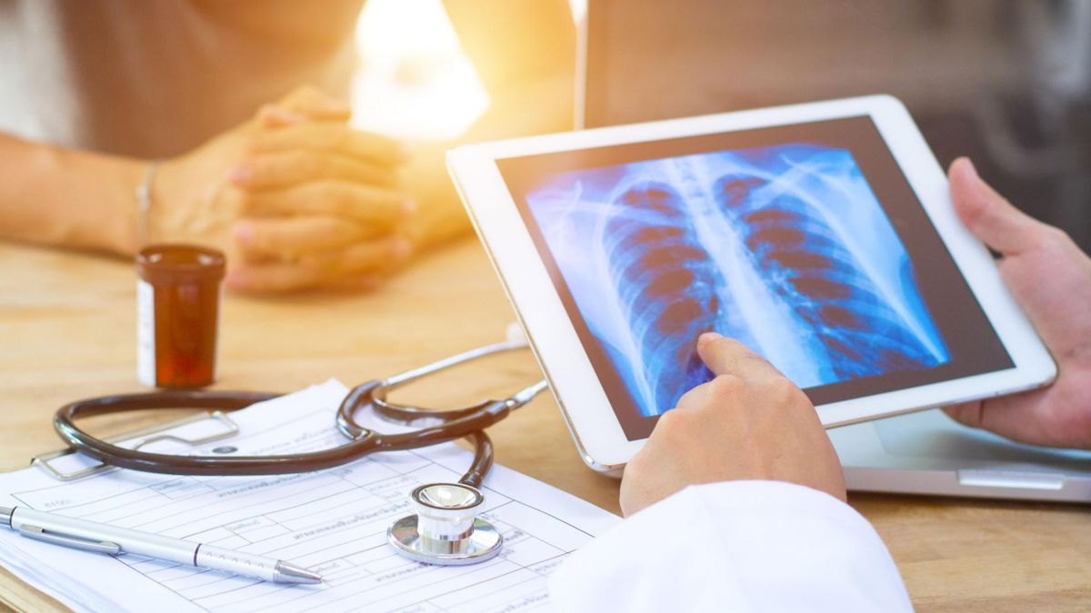 Szacuje się, że ok. 23 tys. Polaków rocznie dowiaduje się, że ma raka płuc