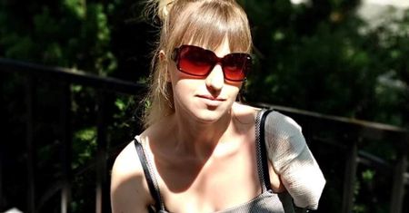 Alona Romanenko straciła rękę podczas pracy w pralni. Kobieta do dzisiaj nie dostała odszkodowania
