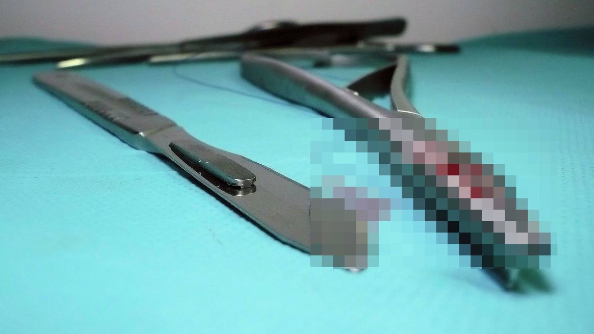 Zmarła kobieta, zaatakowana nożycami chirurgicznymi na oddziale covidowym szpitala w Budapeszcie. 