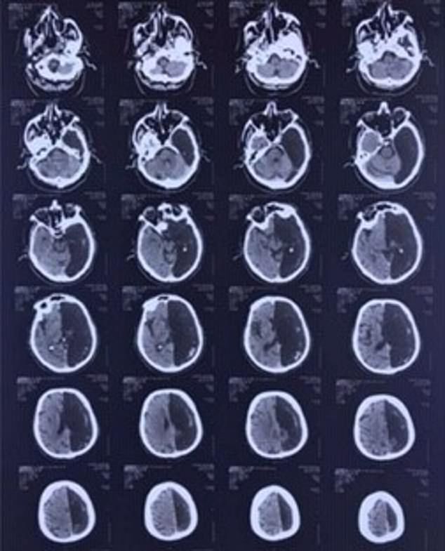 Rosyjscy lekarze nigdy czegoś takiego nie widzieli