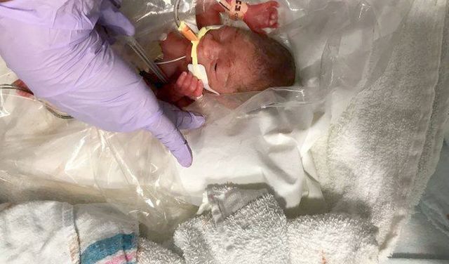 Ministerstwo Zdrowia odmawia refundacji leków dla wcześniaków.