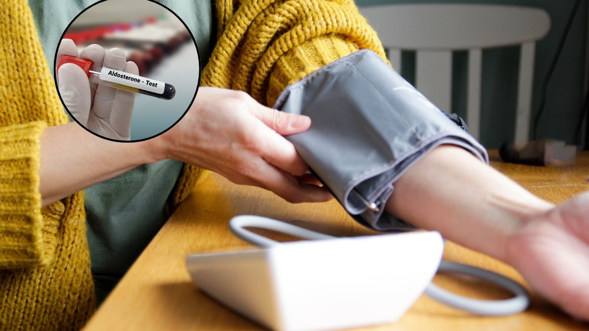 Poziom aldosteronu może mieć znaczenie dla rozwoju nadciśnienia