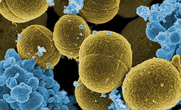 Odporność bakterii na antybiotyki starsza niż medycyna - to wspaniale!