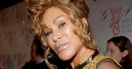 Tak teraz wygląda Jocelyn Wildenstein, najsłynniejsza "Kobieta kot" i miłośniczka operacji plastycznych. Poznajecie? (ZDJĘCIA)