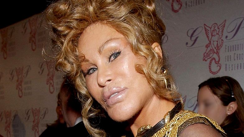 Jocelyn Wildenstein przed laty zasłynęła przemianą w "Kobietę kota". Jak teraz wygląda?
