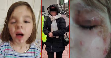 Matka przez lata oszpecała Julkę, a następnie organizowała zbiórki na jej leczenie. 43-latce grozi do 20 lat więzienia
