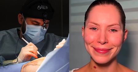Szpital, gdzie wykonano lifting Julii von Stein, wydał oświadczenie po filmie celebrytki: "Zawiera liczne niedomówienia i nieprawdziwe informacje"