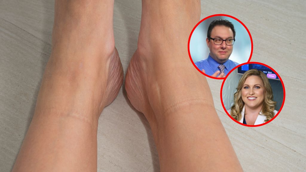 9 sygnałów, których nie wolno ignorować. Tak żyły sygnalizują problem