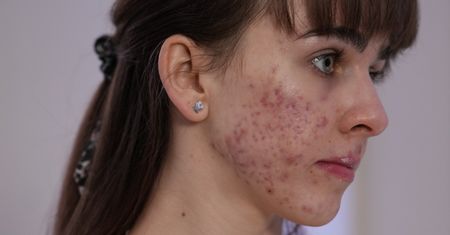 Wzięła udział w programie. Po metamorfozie jest nie do poznania
