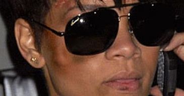 POBITA RIHANNA! FOTO!
