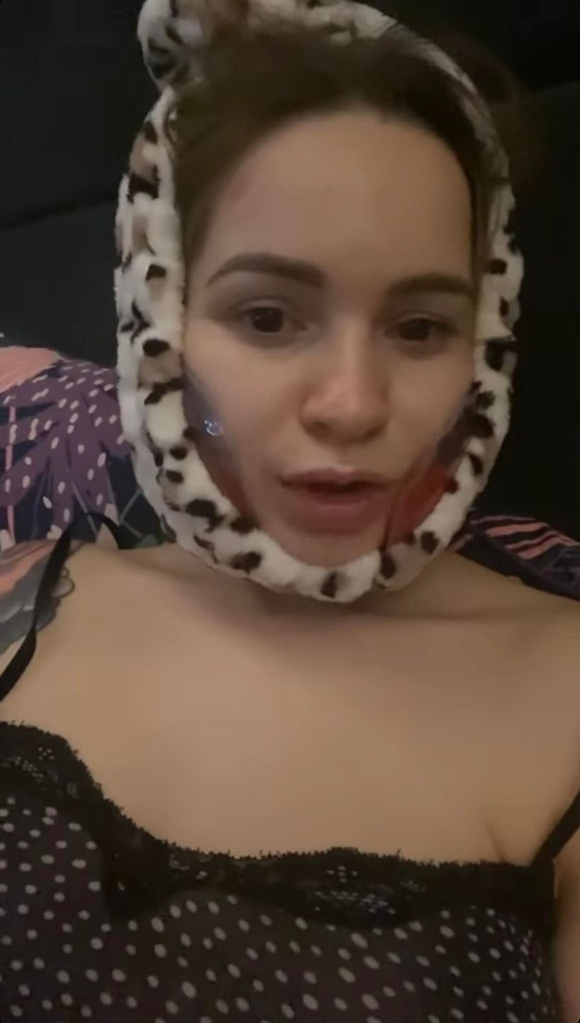 Ewelina Lisowska prezentuje, jak wygląda po zabiegu u dentysty