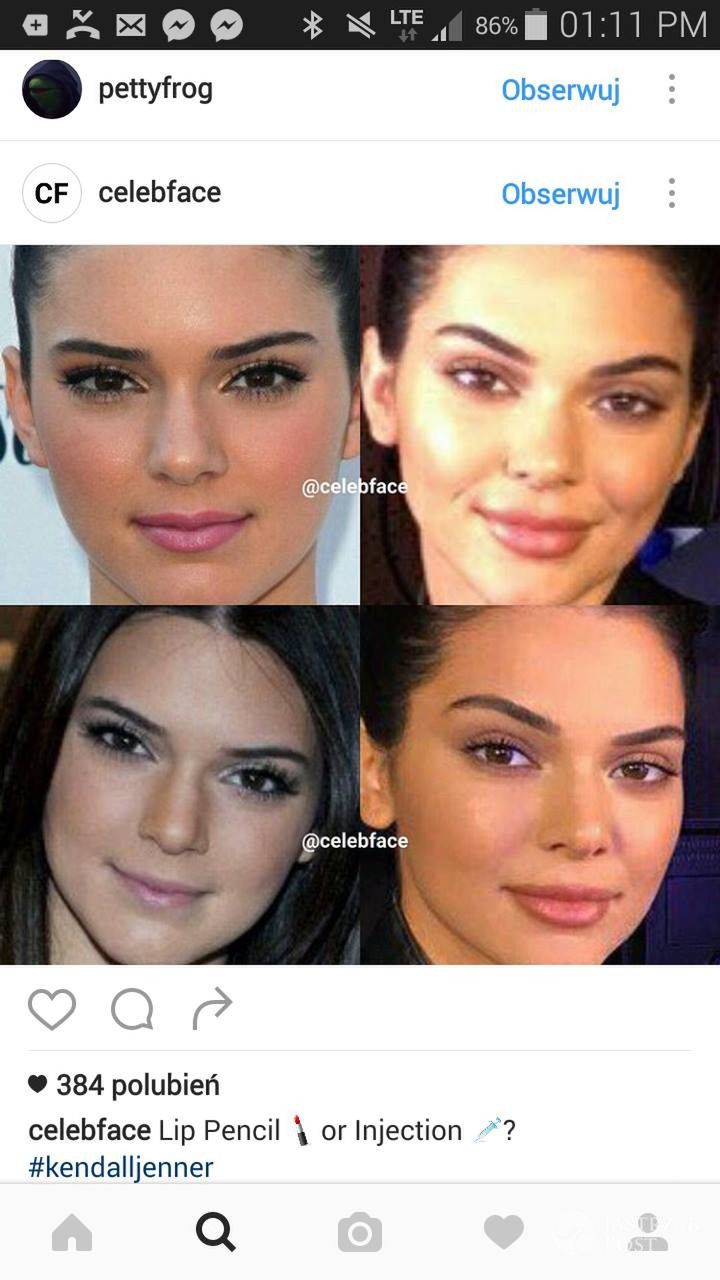 Kendall Jenner poprawiła urodę