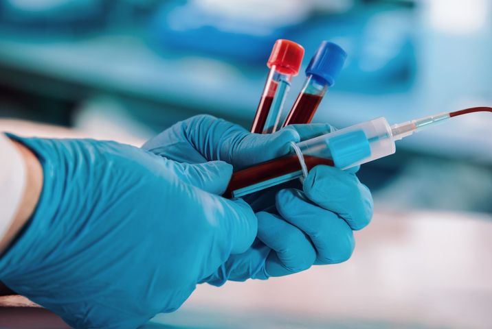 Morfologia krwi obwodowej jest podstawowym, a zarazem najczęściej zlecanym badaniem laboratoryjnym krwi.