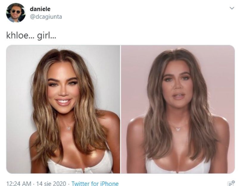 Zagadka rysów twarzy Khloe Kardashian rozwiązana?