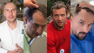 Oni PRZESZCZEPILI SOBIE WŁOSY! Znani panowie, którzy walczyli z łysieniem: Majdan, Qczaj, Koterski... Kto jeszcze poleciał do Turcji? (ZDJĘCIA)