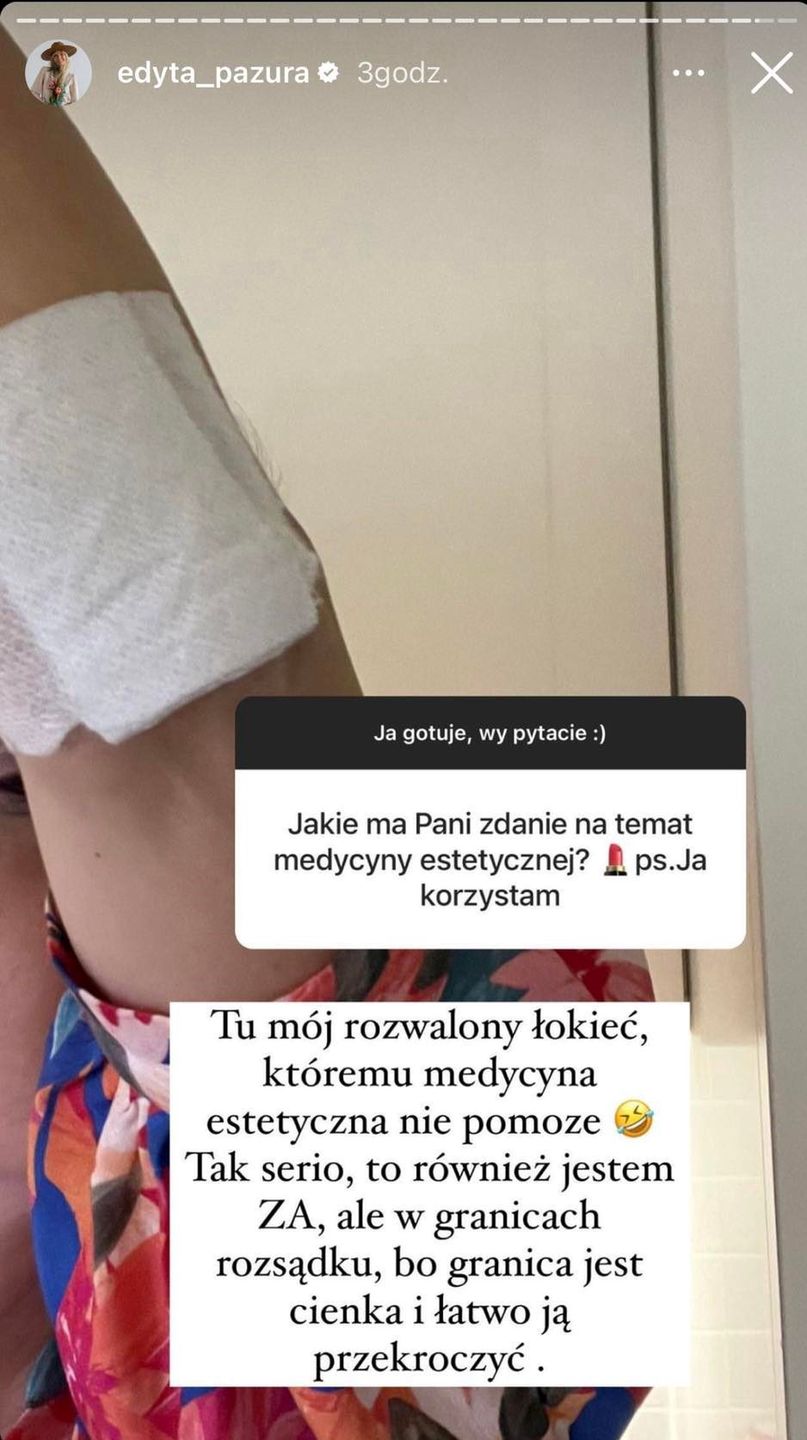 Edyta Pazura zdradza, co sądzi o medycynie estetycznej