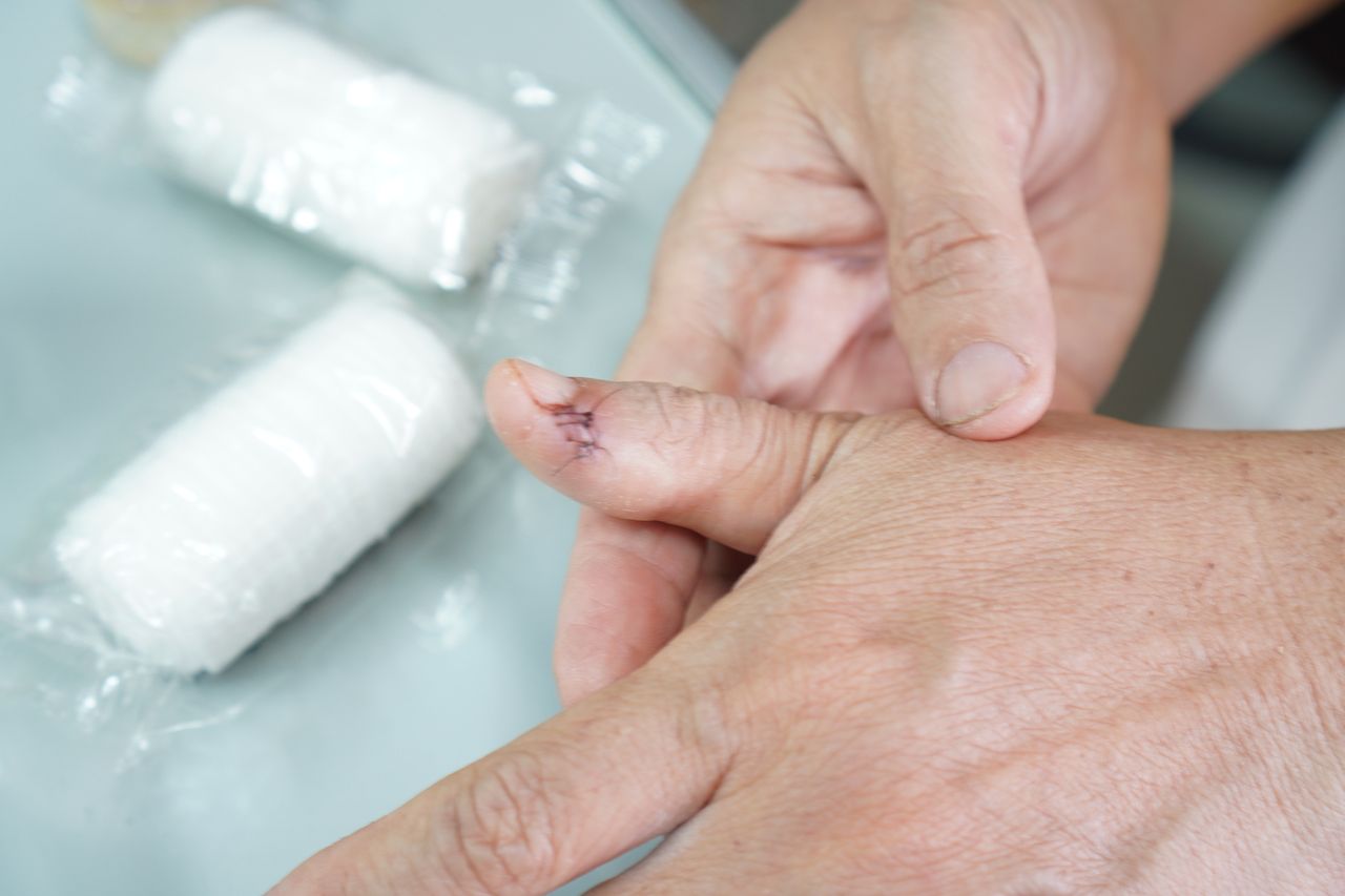 Prawdopodobnie pierwszy taki przypadek. Groźna infekcja odnotowana na Alasce